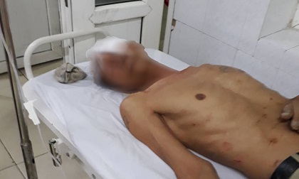 Cán bộ xã cùng vợ con đánh hàng xóm nhập viện