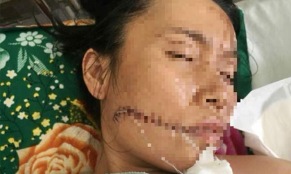 Uẩn khúc phía sau vụ người đàn ông phóng hỏa đốt nhân tình rồi tự thiêu