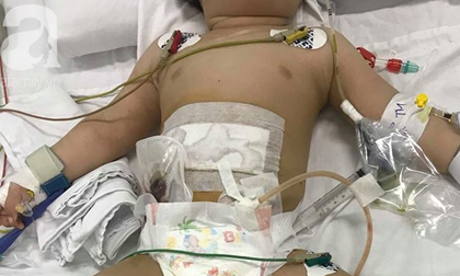 TP.HCM: Bé trai 11 tháng tuổi bị mẹ ruột dùng dao đâm nhiều nhát vào bụng nguy kịch