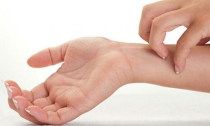 Dị ứng nước - căn bệnh kỳ lạ hiếm gặp nhưng có thật