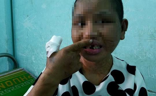 cuoc chay tron khoi 