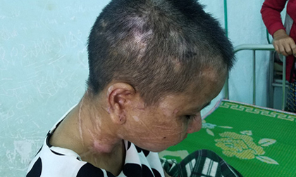 Lời kể rùng rợn của cô gái nghi bị chủ tra tấn dã man
