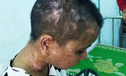 Vụ nữ giúp việc bị tra tấn như thời trung cổ: Truy tìm nghi can thứ 2?