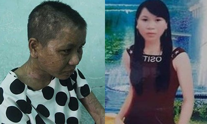 Trước lúc bị nhục hình, Y Nhiêu là một hoa khôi xinh đẹp của làng