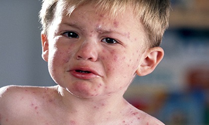 Cảnh báo 5 căn bệnh có thể đe dọa tính mạng bé