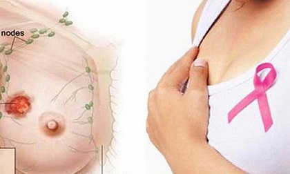 8 căn bệnh nguy hiểm phụ nữ có tỷ lệ mắc phải cao
