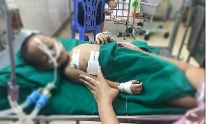 Nghịch súng hơi, bé trai 19 tháng tuổi bị đạn găm vào ngực