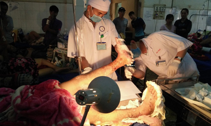 Nam thanh niên bị chém đứt lìa 2 cẳng chân
