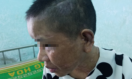 Vụ Nga 'vọc' tra tấn dã man: Yêu cầu thêm 5 người liên quan đến làm việc
