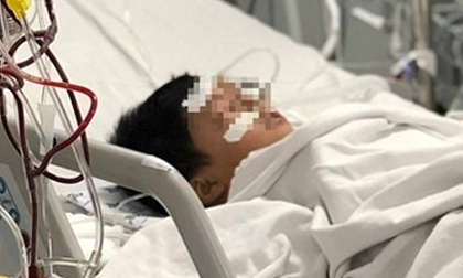 Ong vò vẽ tấn công: 2 người chết, 2 người nguy kịch