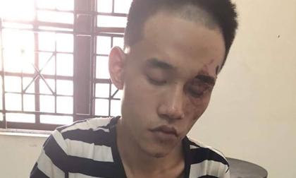 Thông tin mới nhất vụ “đi viếng bạn bị con trai bạn cứa cổ tử vong”