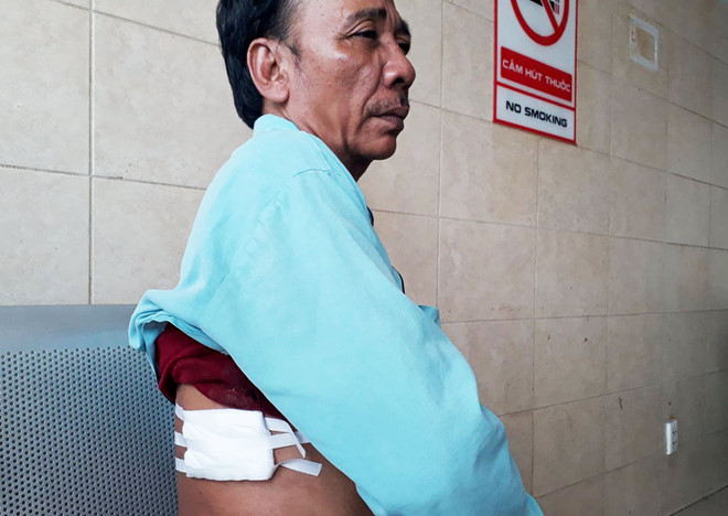 Hiep si bi cuop dam: 'Khong ai dam xong vao, chung binh than di' hinh anh 1