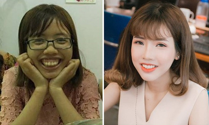 Từng có ý định tử tự vì bị ví 'Thị Nở thời hiện đại', cô gái đến từ Bắc Ninh quyết thẩm mỹ khiến người thân không nhận ra