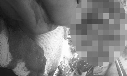 Can ngăn hai con chó béc giê cắn nhau, chủ nhà bị cắn đến chết