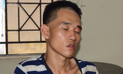 Cứa cổ người đến viếng đám tang cha: Nghi phạm biểu hiện bất thường