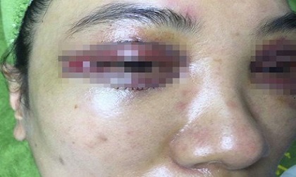 Phát hoảng với những “tác phẩm” làm đẹp của thẩm mỹ vườn