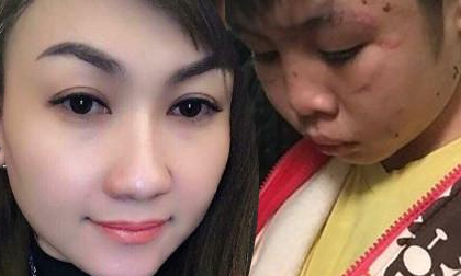 Xử vụ bố và mẹ kế đánh con 10 tuổi: Ngoài bạo hành, bố còn bắt con uống nước mắm