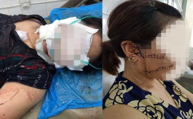 khoi to ga chong mau lanh dung dao rach mat, cat gan chan vo hinh anh 1
