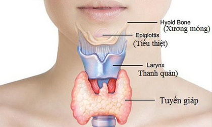 Dấu hiệu nhận biết về bệnh tuyến giáp mà Hoa hậu Phạm Hương mắc phải