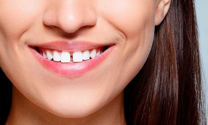Sở hữu tướng mặt này, đừng hỏi sao bị thị phi đeo bám, tiểu nhân hãm hại