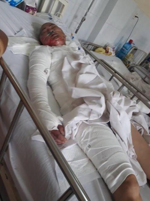 vu 2 be gai bi nguoi tinh cua me thieu chet: loi tuyen bo khung khiep cua ga con do - 1
