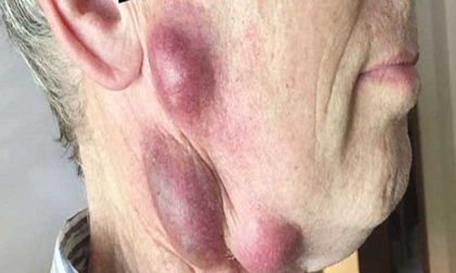 Không ngờ con vật mà rất nhiều nhà đang nuôi lại tiềm ẩn căn bệnh chết người