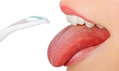 Điểm mặt 6 dấu hiệu bất thường ở vùng lưỡi cảnh báo vấn đề nguy hiểm về sức khỏe không thể bỏ qua