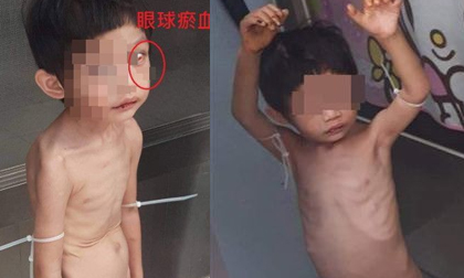 Đến nhà chồng cũ thăm con, người phụ nữ suýt ngất trước cảnh tượng khủng khiếp của con trai 3 tuổi