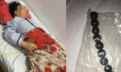 Vụ đứa trẻ bị bạn ép nuốt 9 viên bi nam châm: Hãy dạy trẻ cách yêu bản thân