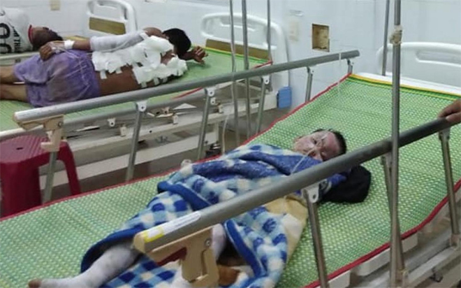 Cháy nhà trong đêm, 2 cha con bị bỏng nặng
