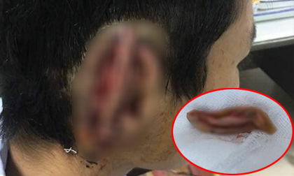 Nam sinh cắn đứt rồi nuốt tai của bạn vào bụng âm tính với ma túy?