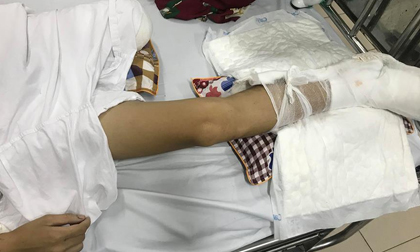 Nạn nhân bị chém nát chân ở Phú Thọ kể lại giây phút kinh hoàng