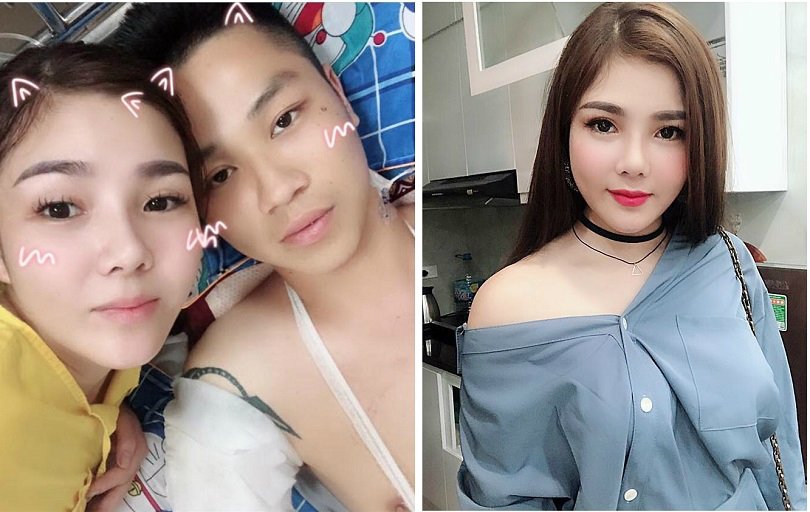 bi to song ao, vo nan nhan bi chem phai cat chan len tieng hinh anh 1