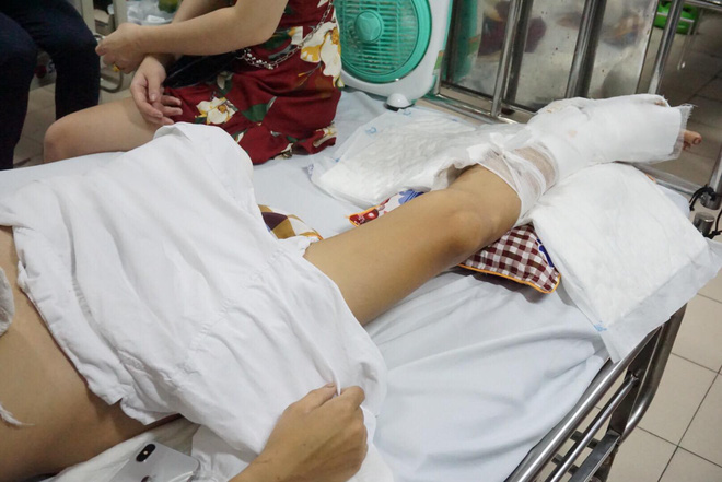 Thanh niên bị nhóm côn đồ truy sát phải cưa chân: Nghi người trong giới làm ăn trả thù - Ảnh 1.