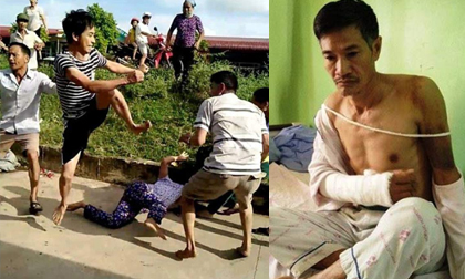 Bị ngăn chặt cây hoa sữa, 8 người xông ra đánh, chém vợ chồng hàng xóm dã man