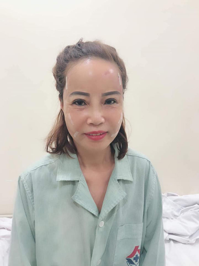 Liên tục livestream, cô dâu 62 tuổi lộ ảnh già nua như chưa thẩm mỹ - 1