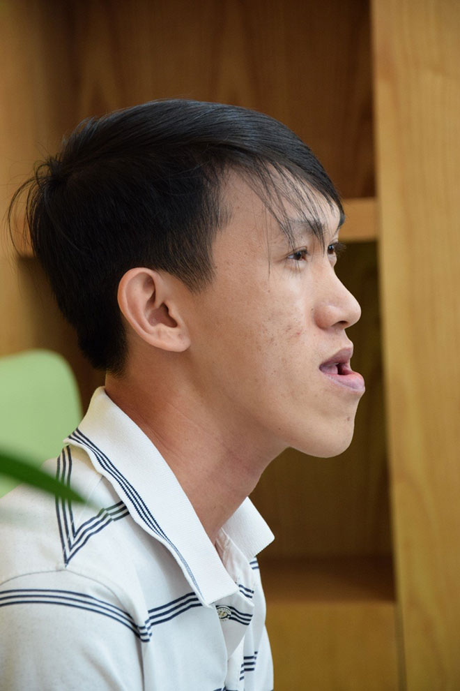 chuyen doi cay dang cua chang thac si “chay xe om” bi miet thi vi guong mat luoi cay - 2