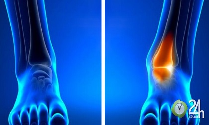 10 dấu hiệu cơ thể ai cũng nghĩ hoàn toàn bình thường nhưng cảnh báo bệnh nan y