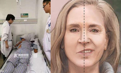Chàng trai 29 tuổi đột nhiên á khẩu, trì hoãn bệnh một phút hàng triệu tế bào não sẽ chết