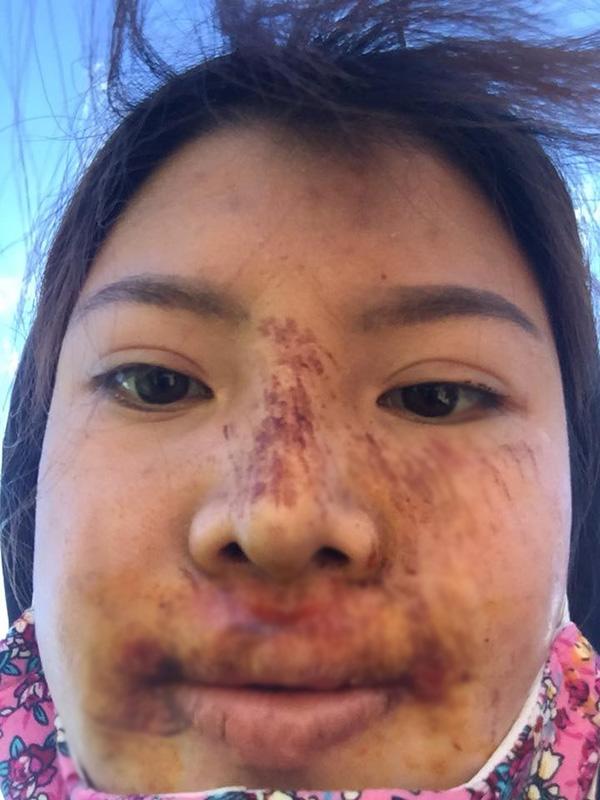 bi che xuong sac hau dao keo, phuong 
