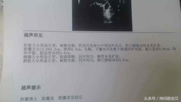 me mac sai lam khi nau nuong khien con 3 tuoi bi soi mat, dung cham con nhu vay! - 2