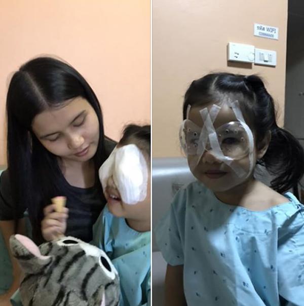 hanh dong sai lam cua cha khi cho con an com khien be gai 4 tuoi phai phau thuat mat - 2