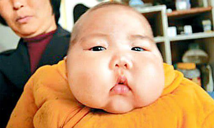 Cháu béo rụt cổ bà vẫn hãnh diện vì 'mát tay', bác sĩ thảng thốt 'bệnh ở mức nghiêm trọng'