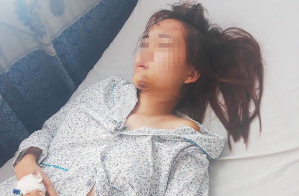 Hé lộ nguyên nhân vụ nữ giáo viên mầm non bị chồng chém nhập viện