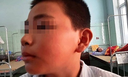 Vụ học sinh hứng 231 cái tát: Khi trường học không 'an toàn' với trẻ
