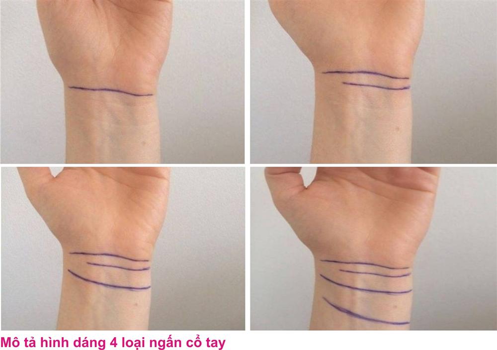 Xem tướng ngấn cổ tay để biết cuộc đời NỞ HOA hay cuộc sống BẾ TẮC-1