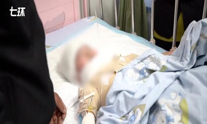 Bé gái 7 tuổi bỏng nặng vì mẹ đổ nước sôi vào người, hé lộ bi kịch gia đình