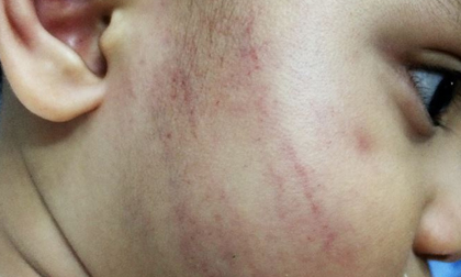 Từ 231 cái tát ở Quảng Bình đến 50 cái tát ở Hà Nội: Bố mẹ dạy con ứng phó thế nào?