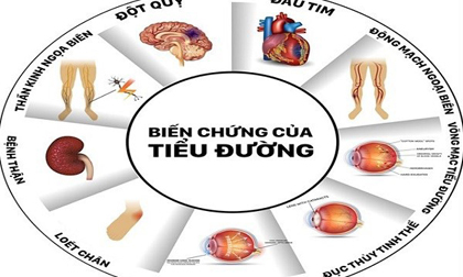 Căn bệnh khiến NSND Anh Tú qua đời gây chết người nhiều thứ 3 Việt Nam