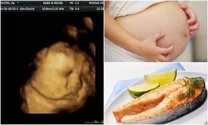 Thai nhi bị suy não, ảnh hưởng đến hệ thần kinh nếu mẹ ăn cá kiểu này